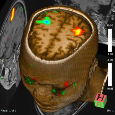 fmri